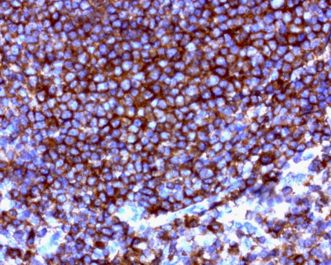 CD20 Antibody - Immunohistochemical staining of paraffin-embedded human spleen using anti-CD20 clone UMAB58 mouse monoclonal antibody at 1:200 dilution of 1mg/mL and detection with Polink2 Broad HRP DAB.requires heat-induced epitope retrieval withCitrate pH6.0 for 3minutes at110C in pressure chamber. The image shows the cells in the white pulp have strong cytoplasmic and membraneous staining.