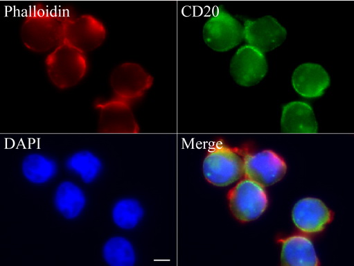CD20 Antibody - Immunofluorescent staining of Jurkat cells using anti-CD20 mouse monoclonal antibody  green, 1:100). Actin filaments were labeled with Alexa Fluor® 594 Phalloidin. (red), and nuclear with DAPI. (blue). Scale bar, 4µm.