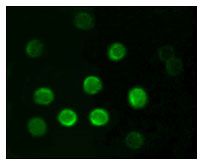 CD20 Antibody - CD20 Antibody in Immunofluorescence (IF)