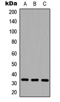 CD20 Antibody - Western blot analysis of CD20 expression in HEK293T (A); Raw264.7 (B); H9C2 (C) whole cell lysates.