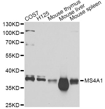 CD20 Antibody - Western blot analysis of extracts of various cell lines, using MS4A1 antibody at 1:1000 dilution. The secondary antibody used was an HRP Goat Anti-Rabbit IgG (H+L) at 1:10000 dilution. Lysates were loaded 25ug per lane and 3% nonfat dry milk in TBST was used for blocking. An ECL Kit was used for detection and the exposure time was 10s.