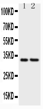 CD20 Antibody - Western blot testing of CD20 antibody (0.5ug/ml) and Lane 1: Raji; 2: CEM lysate