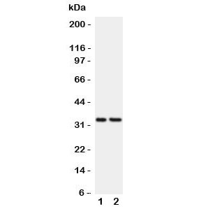 CD20 Antibody - Western blot testing of CD20 antibody and Lane 1: Raji; 2: CEM lysate. Expected/observed size ~33KD