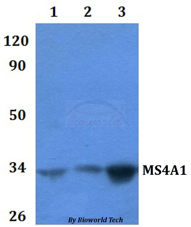 CD20 Antibody - Western blot of MS4A1 antibody at 1:500 dilution. Lane 1: HEK293T whole cell lysate. Lane 2: RAW264.7 whole cell lysate.
