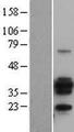 CD20 Protein - Western validation with an anti-DDK antibody * L: Control HEK293 lysate R: Over-expression lysate