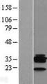 CD20 Protein - Western validation with an anti-DDK antibody * L: Control HEK293 lysate R: Over-expression lysate