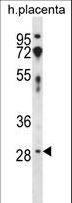 CD200 Antibody - CD200 Antibody western blot of human placenta tissue lysates (35 ug/lane). The CD200 antibody detected the CD200 protein (arrow).