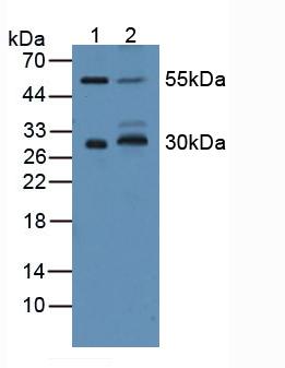 CD200 Antibody - Western Blot; Sample: Lane1: Mouse Brain Tissue; Lane2: Mouse Lung Tissue.