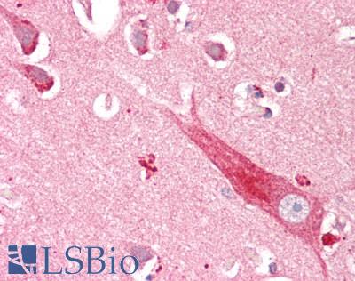 CD200 Antibody - Human Brain, Cortex: Formalin-Fixed, Paraffin-Embedded (FFPE)