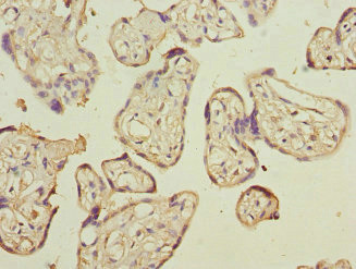 CD200 Antibody - Immunohistochemistry of paraffin-embedded human placenta tissue at dilution 1:100