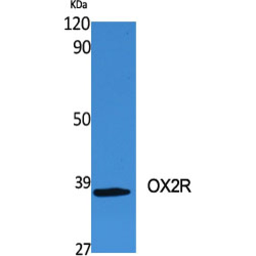 CD200R1 / CD200R Antibody - Western blot of OX2R antibody