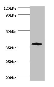 CD200R1 / CD200R Antibody - Western blot All lanes: CD200R1 antibody at 6µg/ml + Mouse lung tissue Secondary Goat polyclonal to rabbit IgG at 1/10000 dilution Predicted band size: 37, 22, 19, 40 kDa Observed band size: 37 kDa