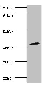 CD200R1 / CD200R Antibody - Western blot All lanes: CD200R1 antibody at 4µg/ml + Mouse lung tissue Secondary Goat polyclonal to rabbit IgG at 1/10000 dilution Predicted band size: 37, 22, 19, 40 kDa Observed band size: 37 kDa