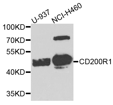 CD200R1 / CD200R Antibody - Western blot analysis of extract of various cells.