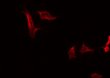 CD200R1 / CD200R Antibody - Staining HeLa cells by IF/ICC. The samples were fixed with PFA and permeabilized in 0.1% Triton X-100, then blocked in 10% serum for 45 min at 25°C. The primary antibody was diluted at 1:200 and incubated with the sample for 1 hour at 37°C. An Alexa Fluor 594 conjugated goat anti-rabbit IgG (H+L) Ab, diluted at 1/600, was used as the secondary antibody.