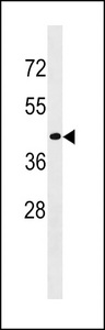 CD200R1L Antibody - CD200R1L Antibody western blot of MDA-MB453 cell line lysates (35 ug/lane). The CD200R1L antibody detected the CD200R1L protein (arrow).