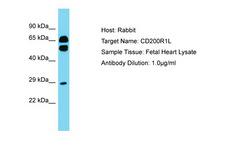 CD200R1L Antibody -  This image was taken for the unconjugated form of this product. Other forms have not been tested.