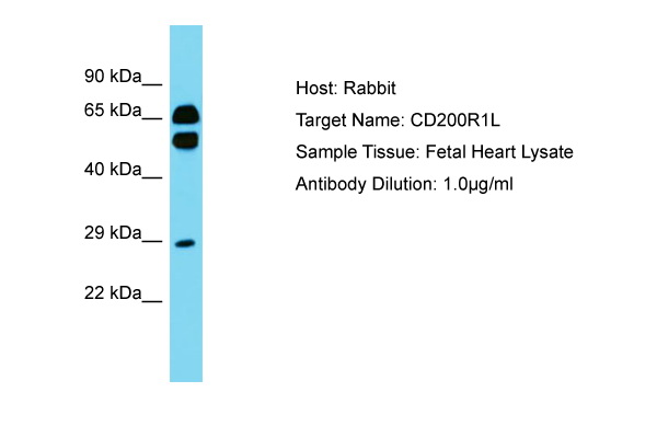 CD200R1L Antibody -  This image was taken for the unconjugated form of this product. Other forms have not been tested.