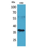 CD207 / Langerin Antibody - Western blot of CD207 antibody