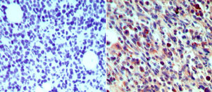 CD207 / Langerin Antibody - IHC of skin Langerin/CD207 in formalin-fixed, paraffin-embedded human (Langerhans cells) using antibody at 2.5 ug/ml. ?Hematoxylin-Eosin counterstain.