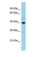 CD207 / Langerin Antibody - CD207 / LANGERIN antibody Western Blot of Fetal Kidney . Antibody dilution: 1 ug/ml.  This image was taken for the unconjugated form of this product. Other forms have not been tested.