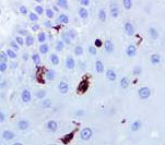CD207 / Langerin Antibody - IHC of Langerin on FFPE Skin tissue. This image was taken for the unmodified form of this product. Other forms have not been tested.