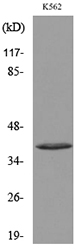 CD207 / Langerin Antibody - Western blot analysis of lysate from K562 cells, using CD207 Antibody.