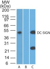 CD209 / DC-SIGN Antibody - Western Blot: DC-SIGN Antibody - Western blot analysis of DC-SIGN (CD209) in human ThP-1 lysate in the A) absence and B) presence of immunizing peptide and C) mouse RAW lysate using DC-SIGN antibody at 3 ug/ml.