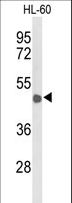 CD209 / DC-SIGN Antibody - Western blot of CD209 Antibody in HL-60 cell line lysates (35 ug/lane). CD209 (arrow) was detected using the purified antibody.