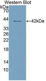 CD209 / DC-SIGN Antibody - Western blot of CD209 / DC-SIGN antibody.