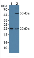 CD209 / DC-SIGN Antibody - Western Blot; Sample: Lane1: Mouse Sp2/0 Cells; Lane2: Mouse Placenta Tissue.