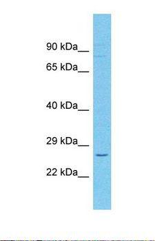 CD209 / DC-SIGN Antibody - Western blot of Human large intestine Tumor. CD209 antibody dilution 1.0 ug/ml.  This image was taken for the unconjugated form of this product. Other forms have not been tested.