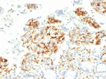 CD209 / DC-SIGN Antibody - IHC testing of FFPE human small intestine with DC-SIGN antibody (clone C209/1781). Required HIER: boil tissue sections in 10mM Tris with 1mM EDTA, pH 9, for 10-20.