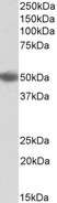 CD209 / DC-SIGN Antibody - Antibody (0.3µg/ml) staining of Human Bone Marrow lysate (35µg protein in RIPA buffer). Primary incubation was 1 hour. Detected by chemiluminescence.