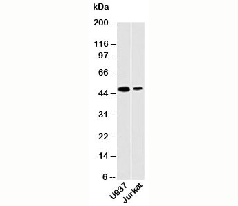 CD209 / DC-SIGN Antibody - DC-SIGN antibody western blot of human samples