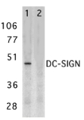 CD209 / DC-SIGN Antibody - Western blot of DC-SIGN expression in human placenta tissue lysate in the absence (lane 1) and presence (lane 2) of blocking peptide with DC-SIGN antibody at 2 ug /ml.