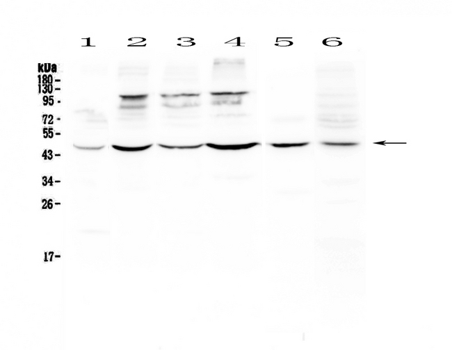 CD209 / DC-SIGN Antibody - Western blot - Anti-DC-SIGN Picoband antibody
