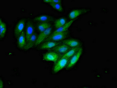 CD209 / DC-SIGN Antibody - Immunofluorescent analysis of HepG2 cells diluted at 1:100 and Alexa Fluor 488-congugated AffiniPure Goat Anti-Rabbit IgG(H+L)