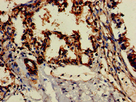 CD209 / DC-SIGN Antibody - Immunohistochemistry of paraffin-embedded human lung tissue at dilution of 1:100