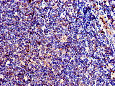 CD209 / DC-SIGN Antibody - Immunohistochemistry of paraffin-embedded human lymph node tissue at dilution of 1:100