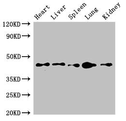CD209 / DC-SIGN Antibody - Western Blot Positive WB detected in:Mouse heart tissue,Mouse liver tissue,Mouse spleen tissue,Mouse lung tissue,Mouse kidney tissue All Lanes:CD209 antibody at 4µg/ml Secondary Goat polyclonal to rabbit IgG at 1/50000 dilution Predicted band size: 46,36,19,44,42,31,5,38,34 KDa Observed band size: 46 KDa