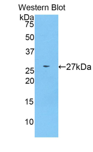CD22 Antibody - Western blot of recombinant CD22.  This image was taken for the unconjugated form of this product. Other forms have not been tested.