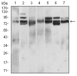 CD22 Antibody - Western blot using CD22 mouse monoclonal antibody against L1210 (1), HeLa (2), HEK293 (3), Jurkat (4), OCM-1 (5), A432 (6) and NIH/3T3 (7) cell lysate.