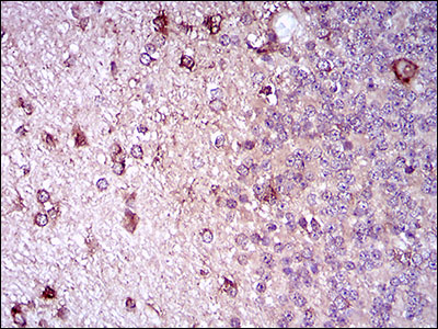 CD22 Antibody - IHC of paraffin-embedded cerebellum tissues using ZEB1 mouse monoclonal antibody with DAB staining.