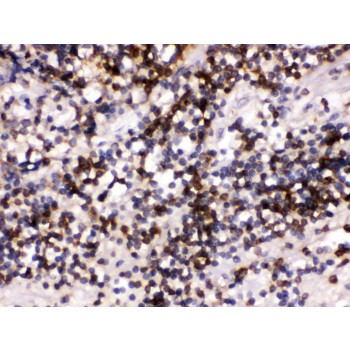 CD22 Antibody - CD22 antibody IHC-paraffin. IHC(P): Human Tonsil Tissue.