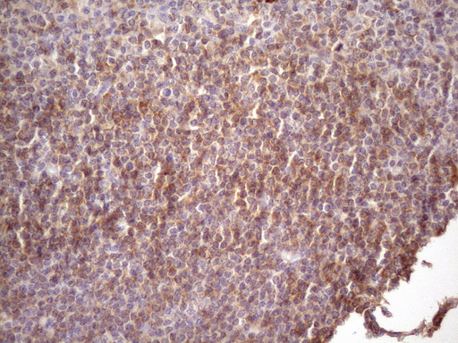 CD22 Antibody - Immunohistochemical staining of paraffin-embedded Human tonsil within the normal limits using anti-CD22 mouse monoclonal antibody. (Heat-induced epitope retrieval by 1 mM EDTA in 10mM Tris, pH8.5, 120C for 3min. (1:150)