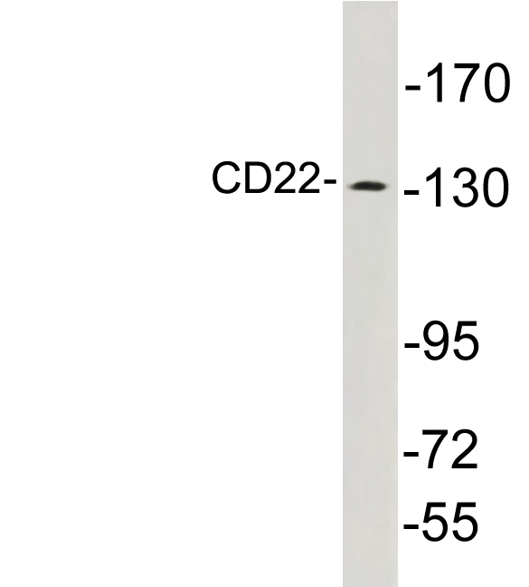 CD22 Antibody - Western blot analysis of lysates from K562 cells, using CD22 antibody.