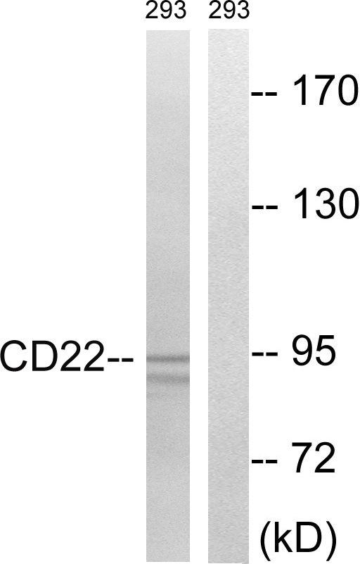 CD22 Antibody - Western blot analysis of lysates from 293 cells, treated with Ca2+ 40nM 30', using BL-CAM Antibody. The lane on the right is blocked with the synthesized peptide.