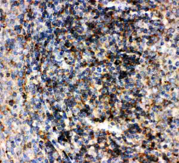 CD22 Antibody - Anti-CD22 antibody, IHC(P): Human Tonsil Tissue