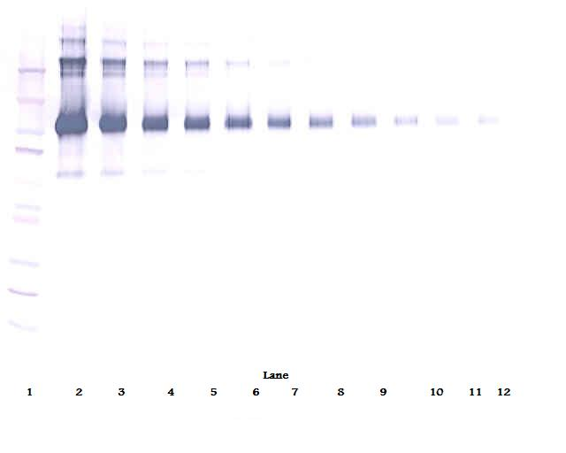 CD22 Antibody - Biotinylated Anti-Human sCD22 Western Blot Unreduced